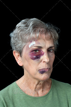 Beaten elderly woman stock photo NULLED